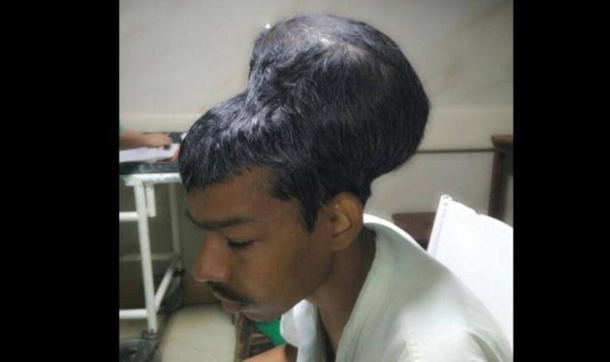 Tumor - India