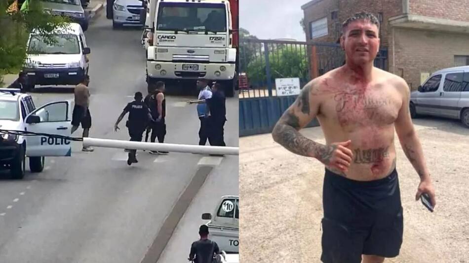 Brian Medina resultó herido luego del enfrentamiento. Fotos: captura Municipalidad de Ensenada