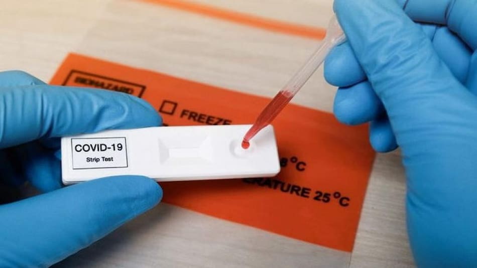 Test contra el coronavirus