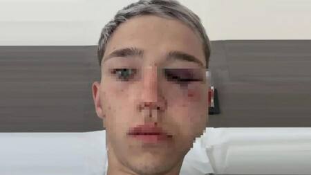 Quiénes son los rugbiers acusados de darle una paliza y desfigurar a un adolescente en una fiesta