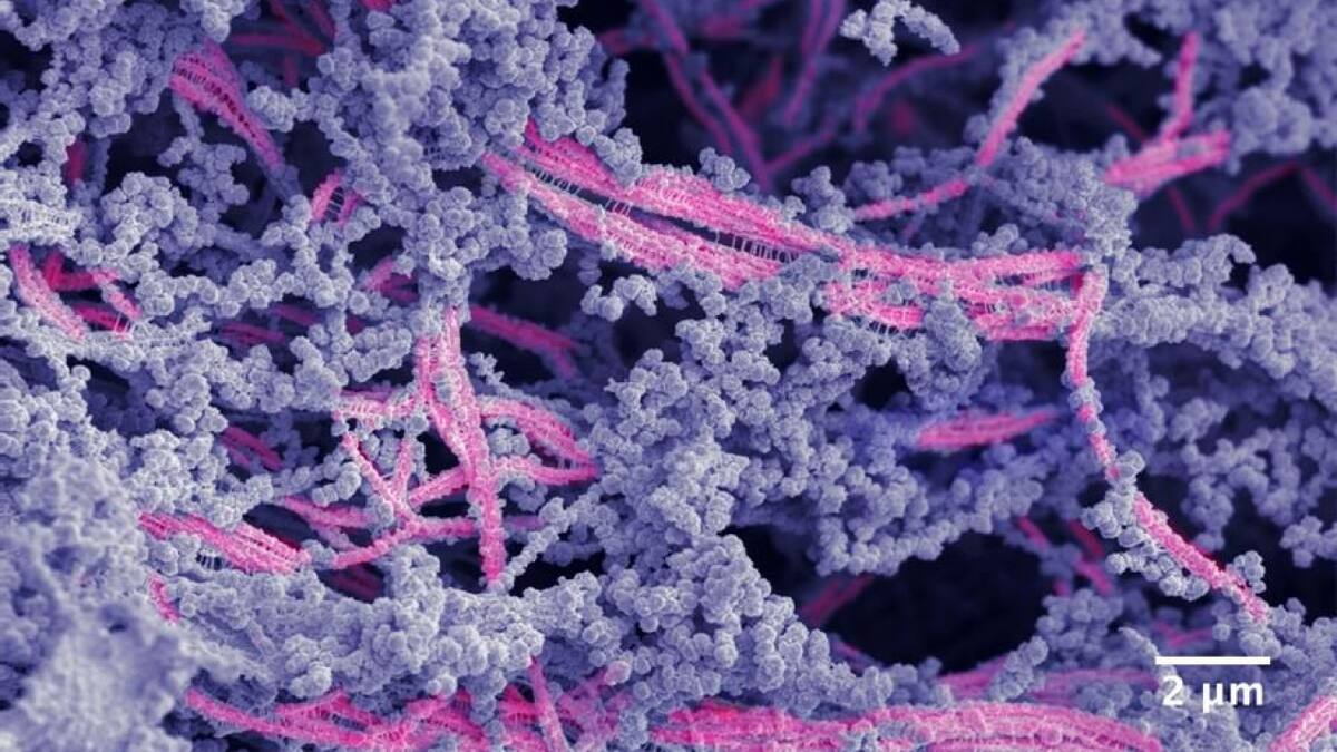Crean un biomaterial capaz de regenerar cartílago dañado. Foto: X