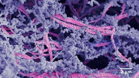 Crean un biomaterial capaz de regenerar cartílago dañado. Foto: X