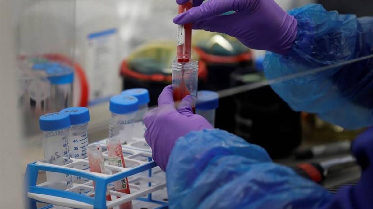 Ensayos de hidroxicloroquina contra el coronavirus