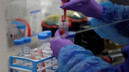 Ensayos de hidroxicloroquina contra el coronavirus