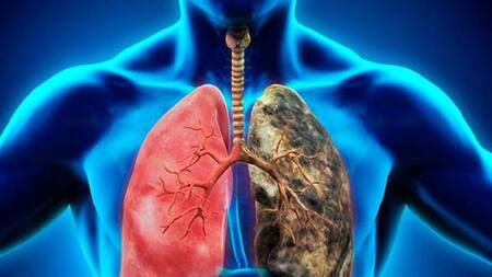 Cáncer de pulmón, salud