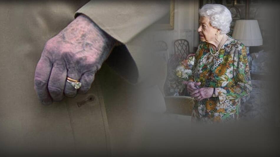 El misterio de las manos moradas de la reina Isabel II de Inglaterra