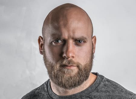 Pelado; calvo; calvicie. Foto: Unsplash.