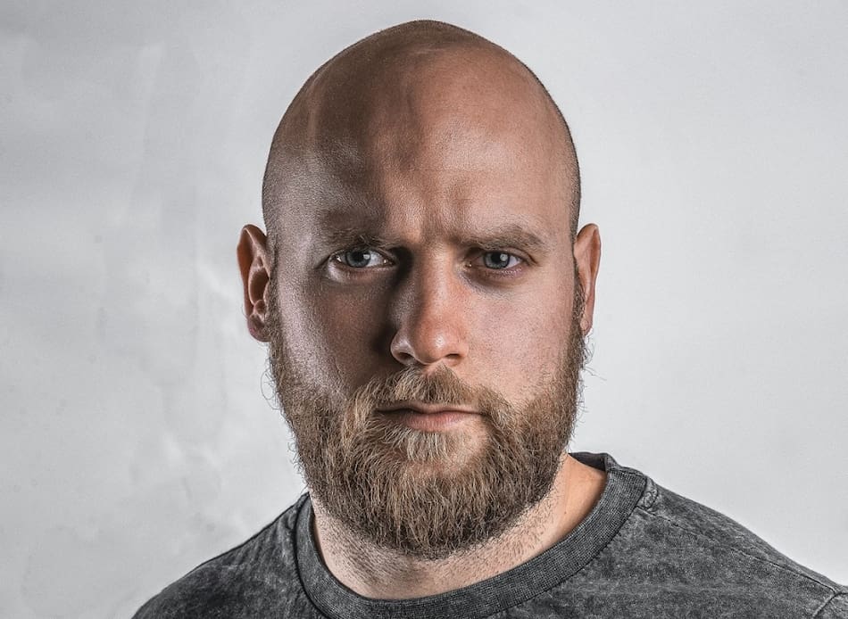 Pelado; calvo; calvicie. Foto: Unsplash.