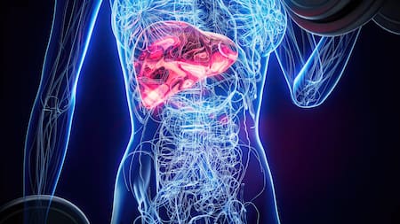 Cáncer de páncreas.