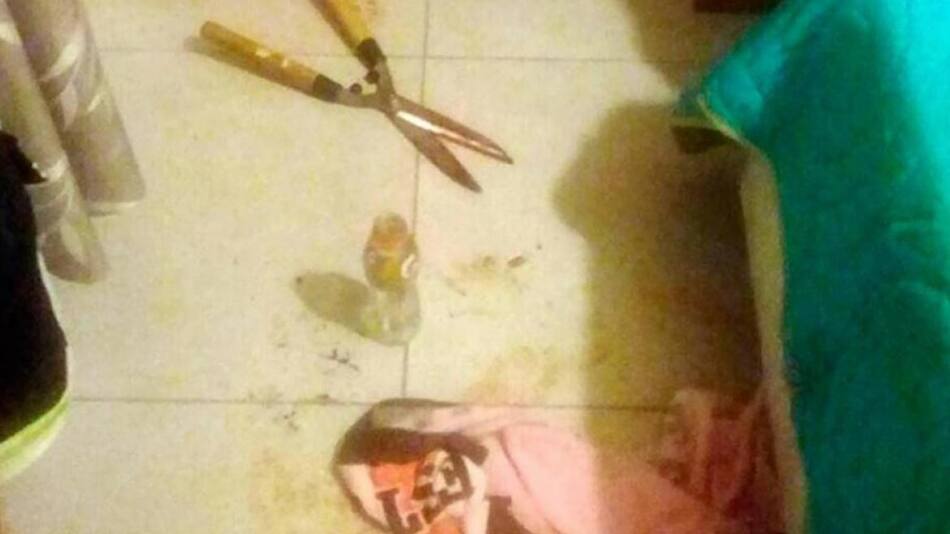 Mujer corta genitales