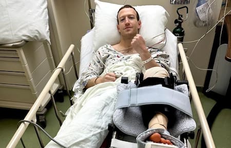 Mark Zuckerberg, lesión. Foto: @zuck