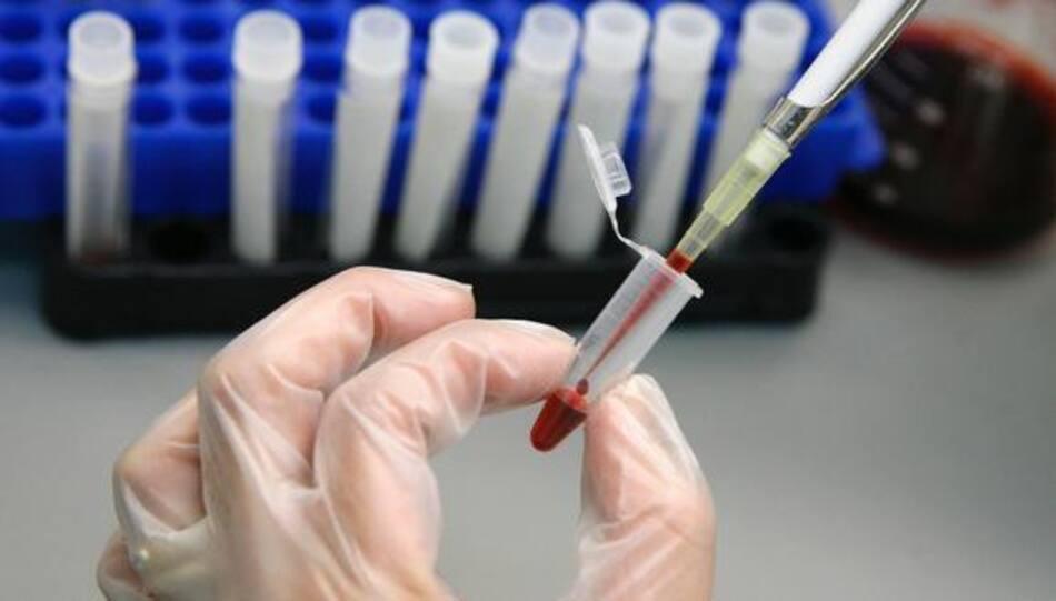 Día Mundial de la Lucha contra el Sida, Reuters