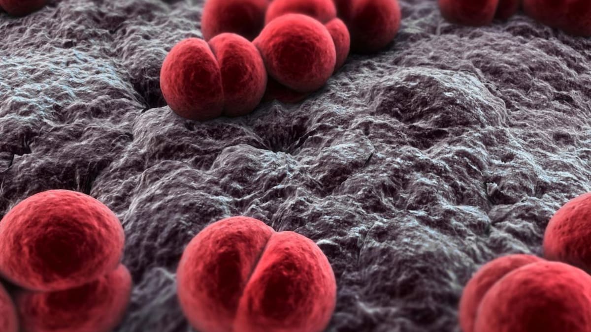 Meningitis