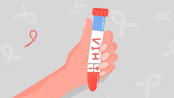 Aumentaron los caso de VIH en América Latina: el 25% de los pacientes no accede a un tratamiento