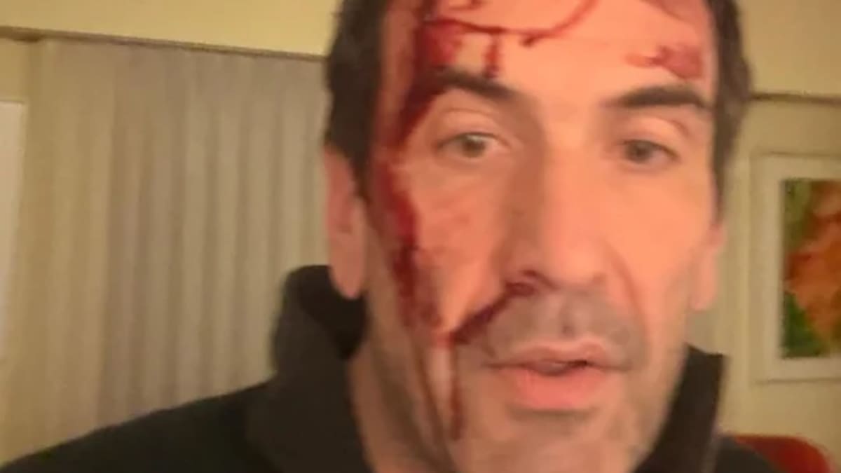 Pablo Cervi, candidato a senador por LLA, fue brutalmente golpeado en la previa de las elecciones legislativas.