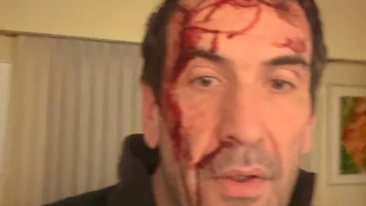 El candidato a senador por LLA, Pablo Cervi, fue brutalmente atacado en la previa de las elecciones legislativas 2025