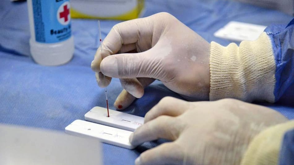 Testeos en la Ciudad, coronavirus, Agencia NA