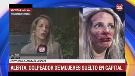 Mujer golpeada en Caballito - Canal 26