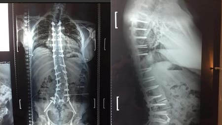 Ricardo Fort, radiografías