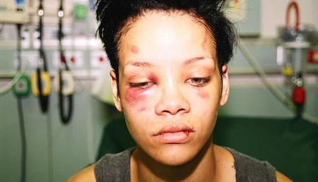Rihanna golpeada por Chris Brown