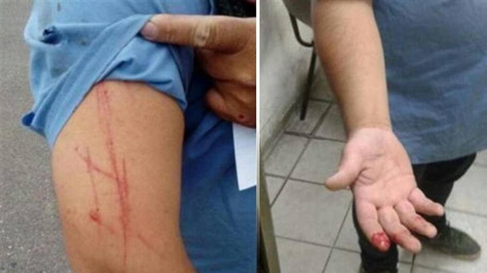 Colectivero atacado - Línea 169 - Inseguridad