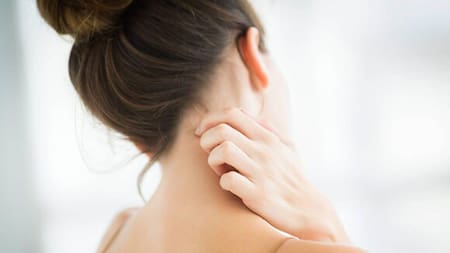 Dermatitis atópica, enfermedad de la piel, salud