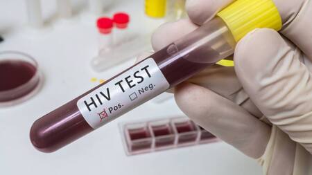 VIH positivos. Foto: Twitter