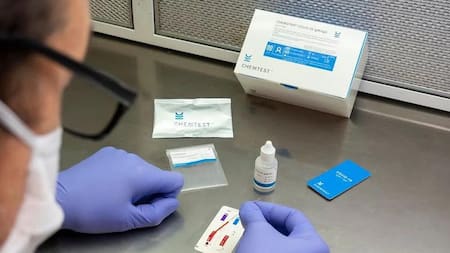 CHEMSTRIP, test rápido, foto agencia