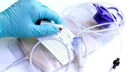 La importancia de la alimentación por sonda en la recuperación de pacientes internados