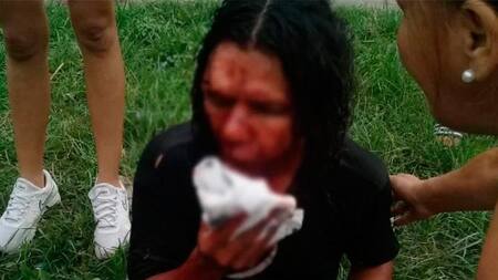 Ataque homofóbico - Tucumán