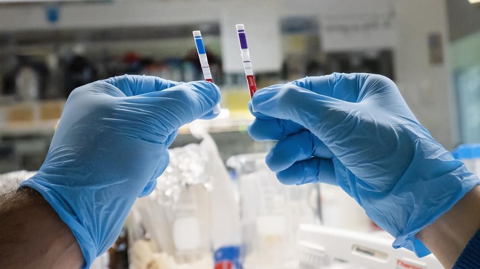 Coronavirus en Argentina, nuevo test de científicos argentinos