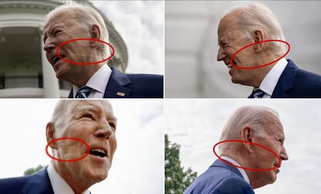 Marcas en la cara de Joe Biden. Fotos: Twitter@judytgolf