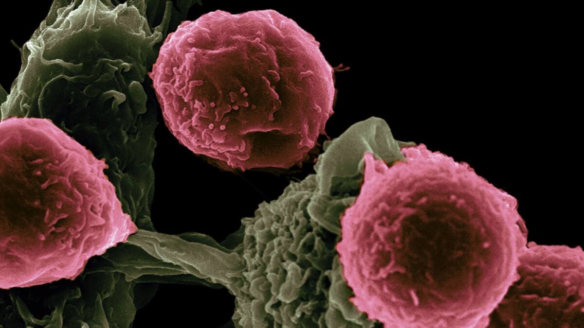 Cáncer. Foto: Unsplash.