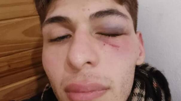 Atacan a golpes a una persona no binaria y con síndrome de Asperger en La Plata