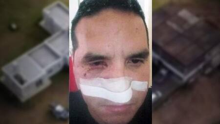 Baleado por Rey de La Salada