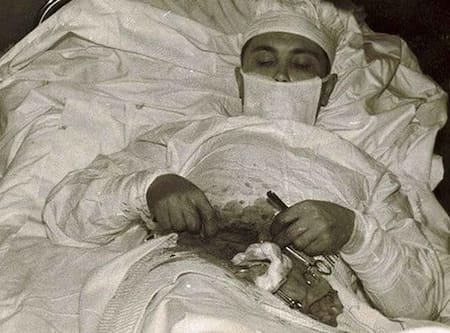 Leonid Rógozov, el médico cirujano que se operó a sí mismo