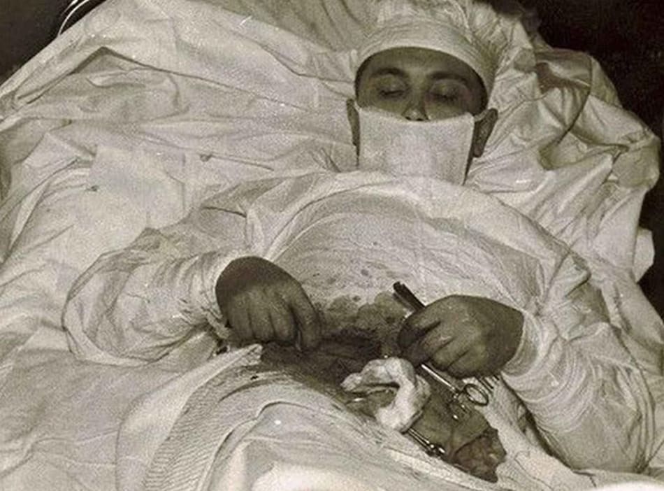Leonid Rógozov, el médico cirujano que se operó a sí mismo