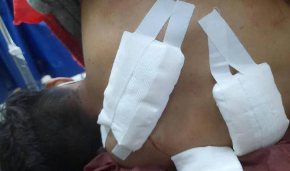 El joven de 17 años fue apuñalado por la espalda. Foto: El Liberal.