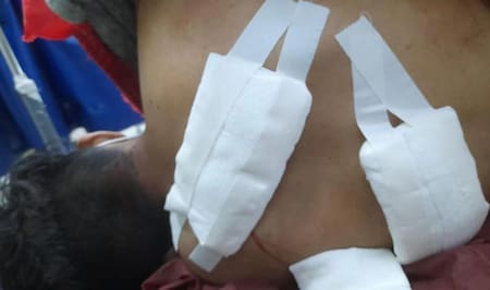 El joven de 17 años fue apuñalado por la espalda. Foto: El Liberal.