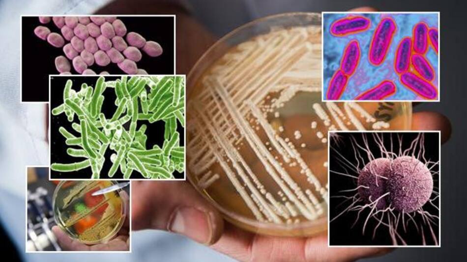 ¿Cuáles son las superbacterias más resistentes?