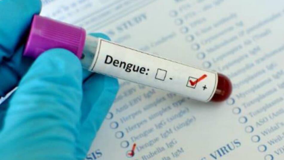 Dengue, análisis en laboratorio, estudios