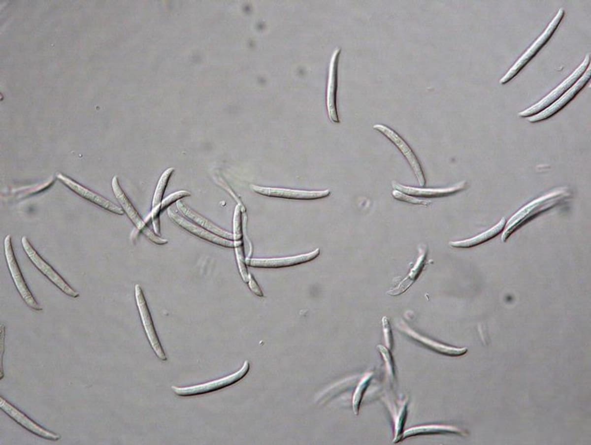 Fusarium Solani, hongo. Foto: Wikipedia