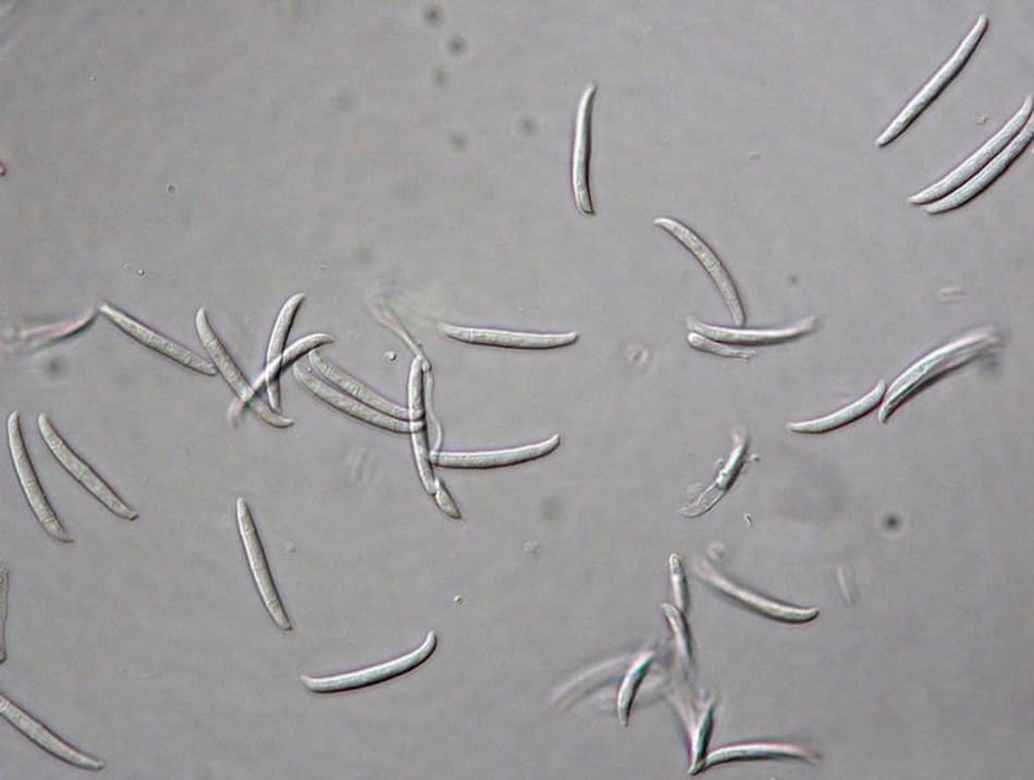 Fusarium Solani, hongo. Foto: Wikipedia