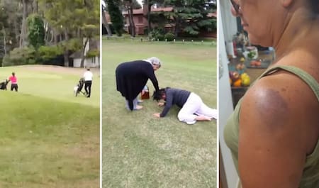 La golpiza que recibió la mujer de 61 años en el campo de golf. Foto: X.