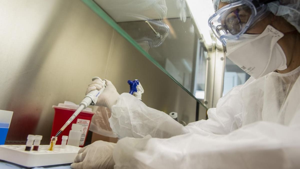 Vacuna, coronavirus en Argentina, Agencia NA