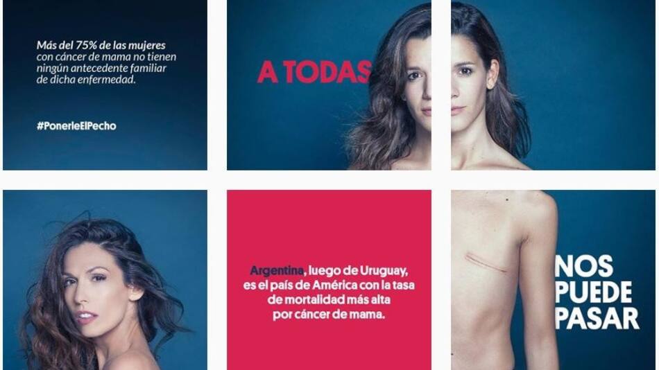 Cáncer de mama