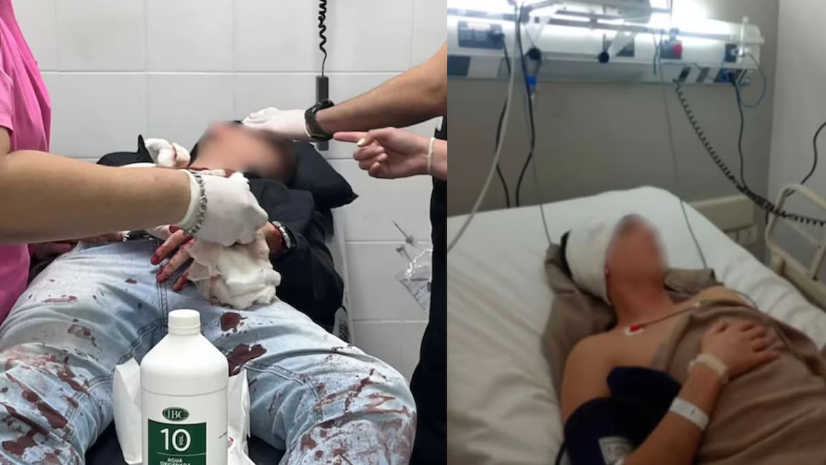 Una discusión por el ascensor terminó en una brutal golpiza a una pareja gay en Tucumán: hay un joven en terapia intensiva