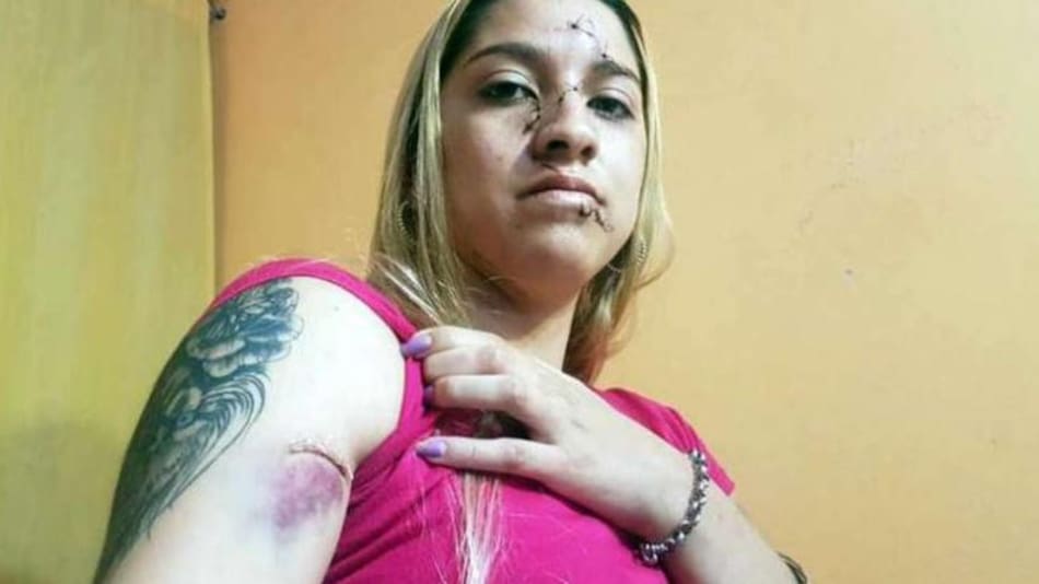 Melisa, joven agredida en Córdoba
