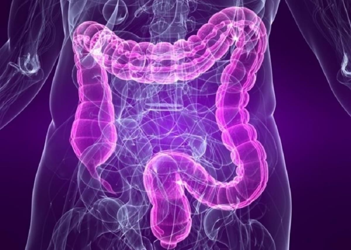 Colón, Cáncer de colon, intestino, salud