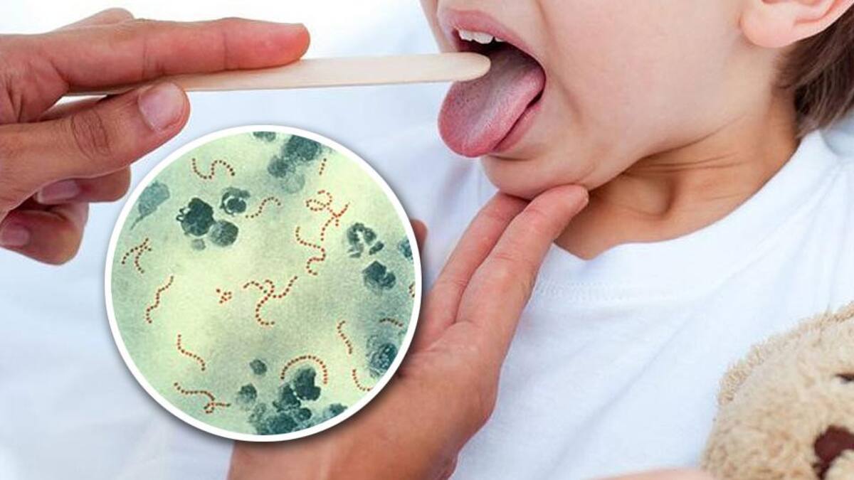 Estreptococo pyogenes - Bacteria - Salud - Medicina